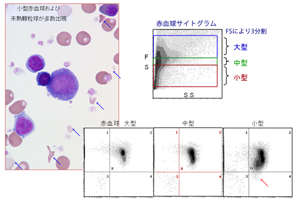 異型骨髄移植における赤血球除去検体を用いたCD55,59染色像