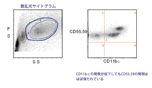未熟な骨髄球系細胞を多く含む検体でのPNH型血球(CD55,59染色)の染色性