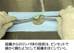 歯科用コーク型などのピンセット