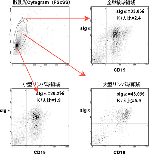 3 解析方法 1 フローサイトメーターによる悪性リンパ腫の解析 A To Z サイトメトリードットコム
