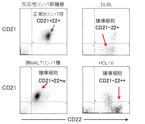 CD21 & 22の抗原発現強度